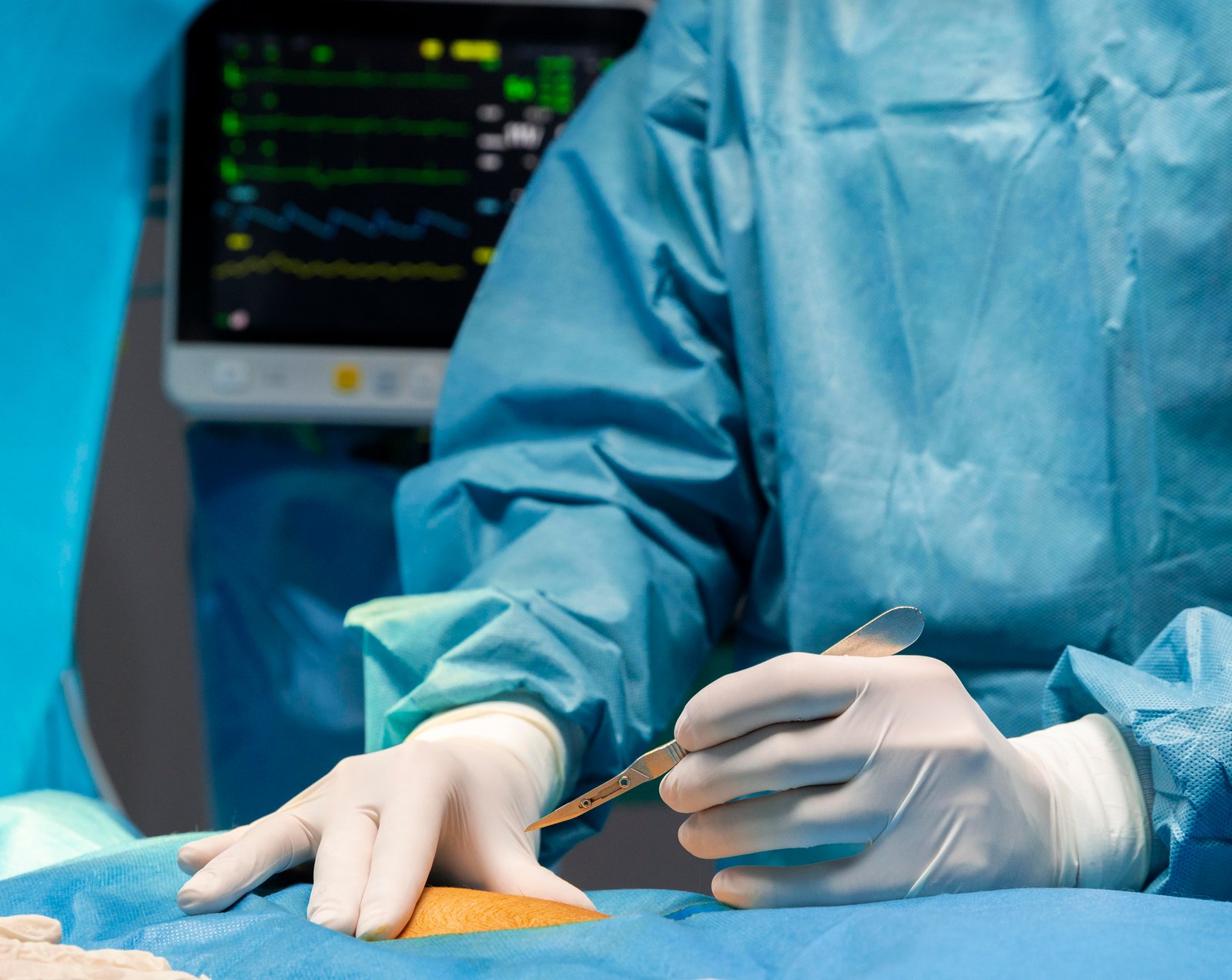 Orthopedic Corrective Surgeries
